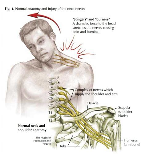 medial nerve nerve root compression tests|what is deep neck compression.